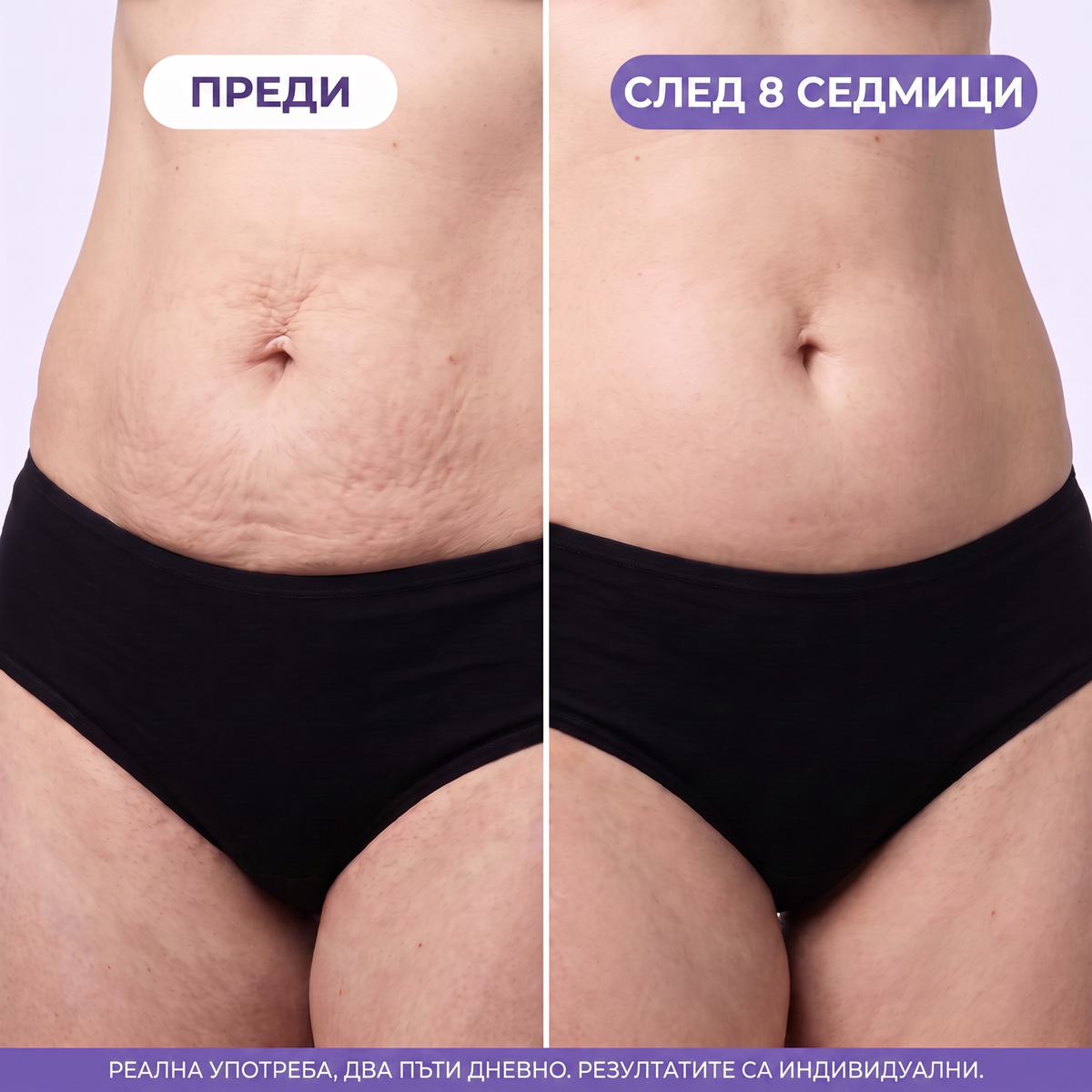 Преди и след 8 седмици